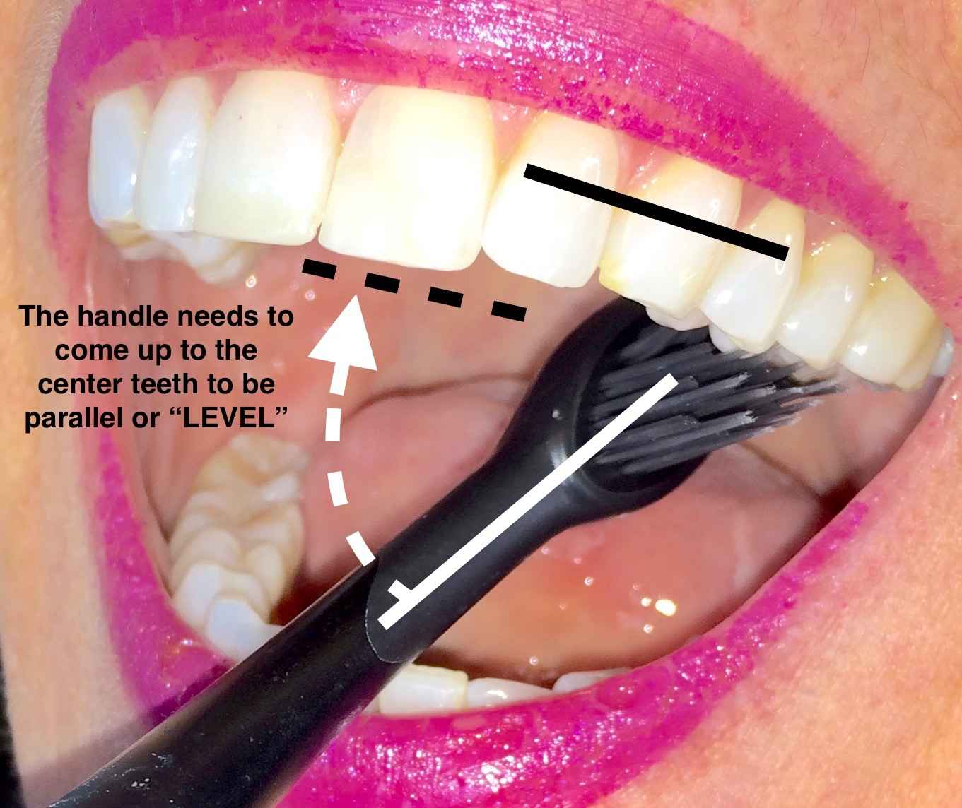 Image Title My Image