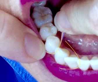 Image Title My Image